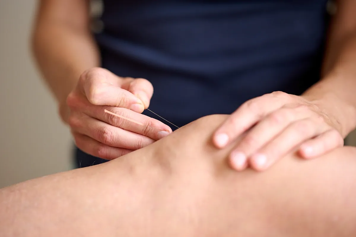 Inserción de aguja de acupuntura en la articulación de la rodilla como parte de una terapia tradicional china en Oaxaca.